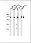 ACSM5 Antibody (C-term)